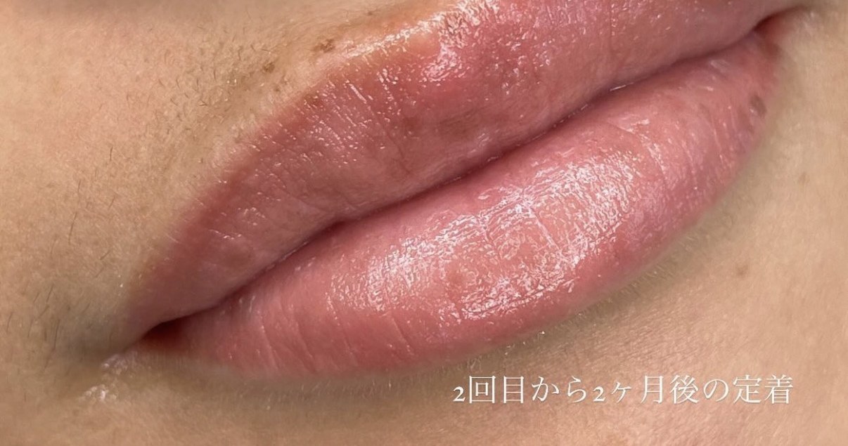 リップアートメイク 術後（2回目から2ヶ月後の定着）